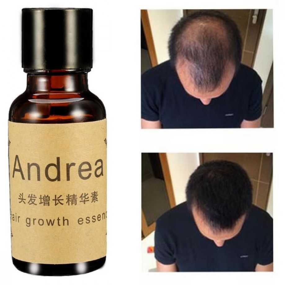     ANDREA Hair Growth Essence     Andrea,   ,     ,       